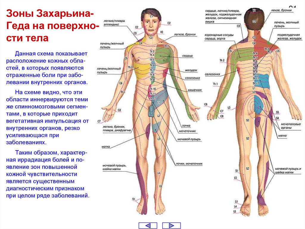 Зоны Захарьина-Геда на поверхно-сти тела
