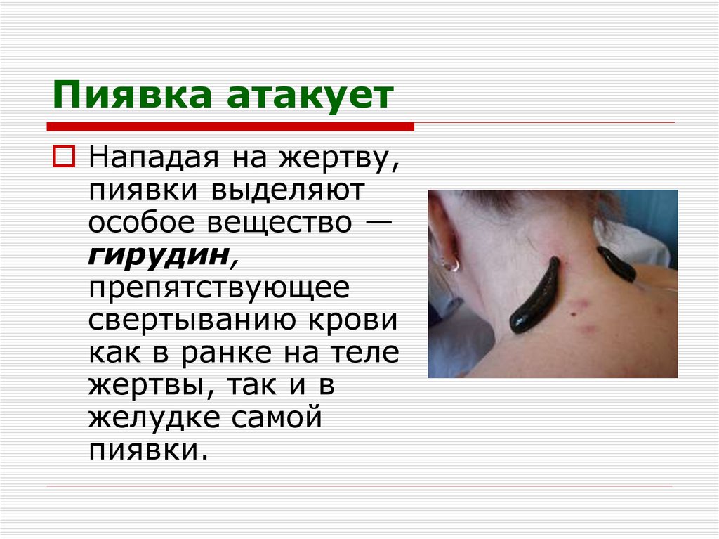 Пиявка атакует