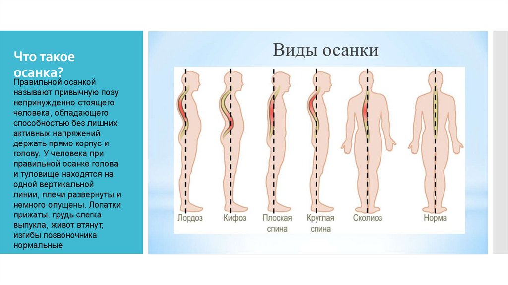 Что такое осанка?