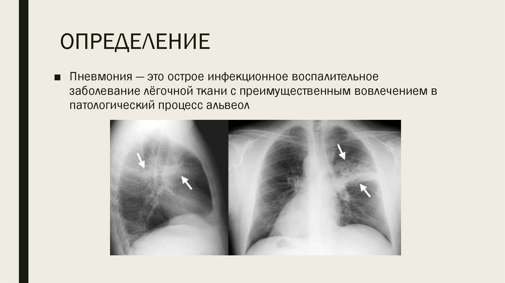 ОПРЕДЕЛЕНИЕ