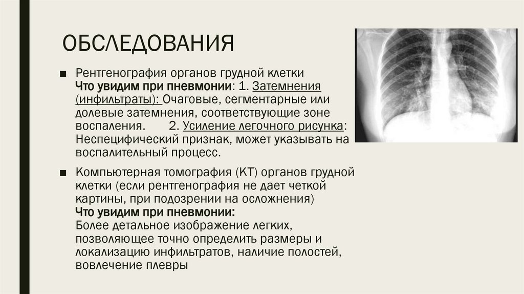 ОБСЛЕДОВАНИЯ