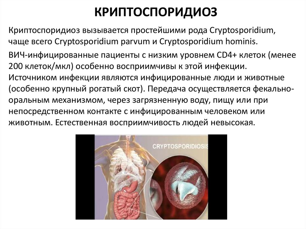 КРИПТОСПОРИДИОЗ