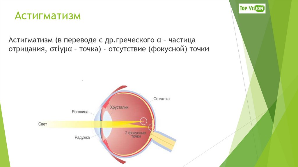 Астигматизм