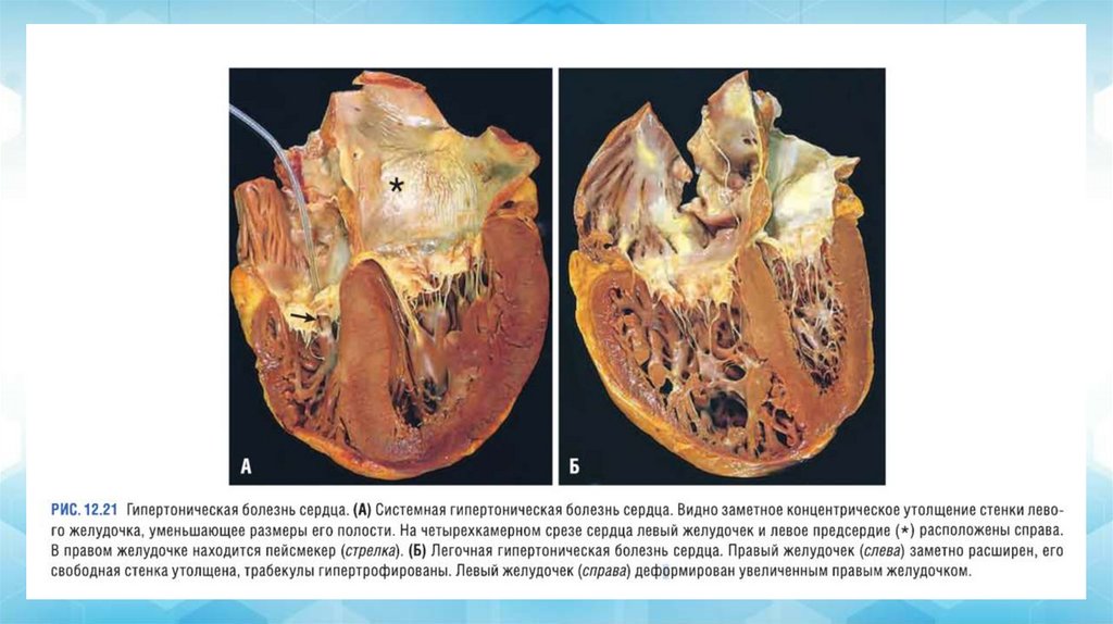 ЗАКЛЮЧЕНИЕ