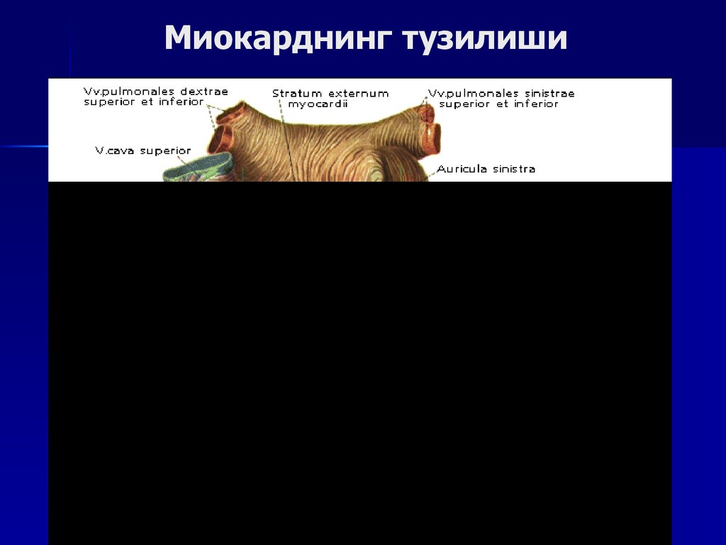 Миокарднинг тузилиши