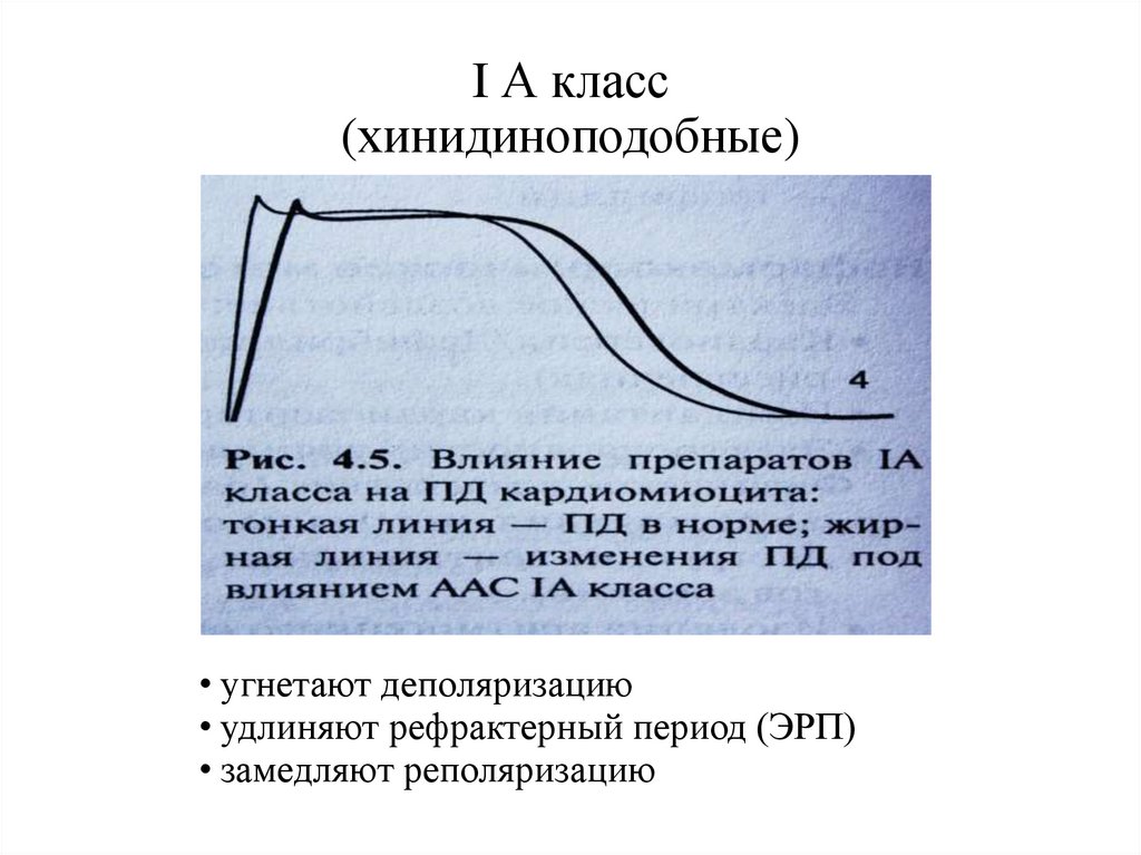 I А класс (хинидиноподобные)