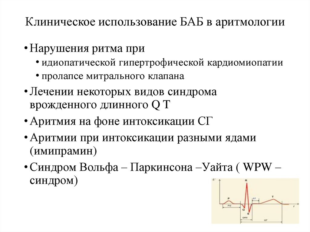 Клиническое использование БАБ в аритмологии