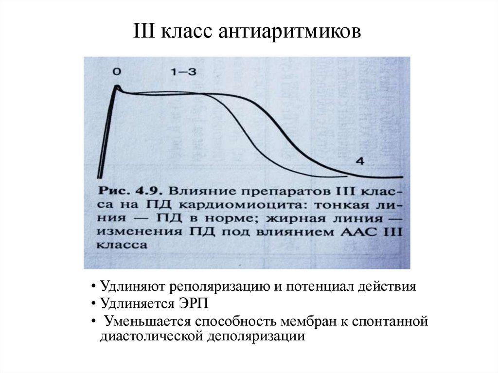 III класс антиаритмиков
