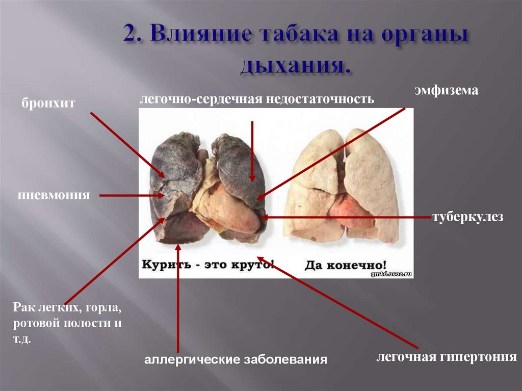 2. Влияние табака на органы дыхания.