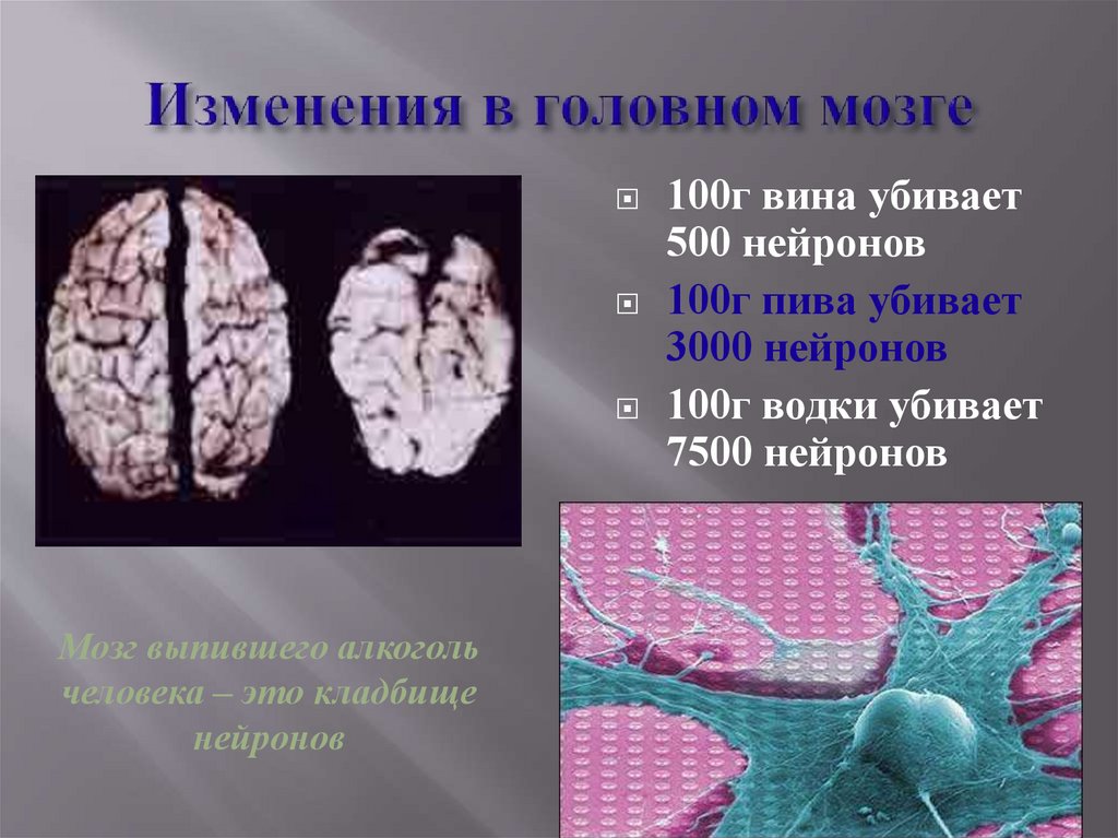 Изменения в головном мозге