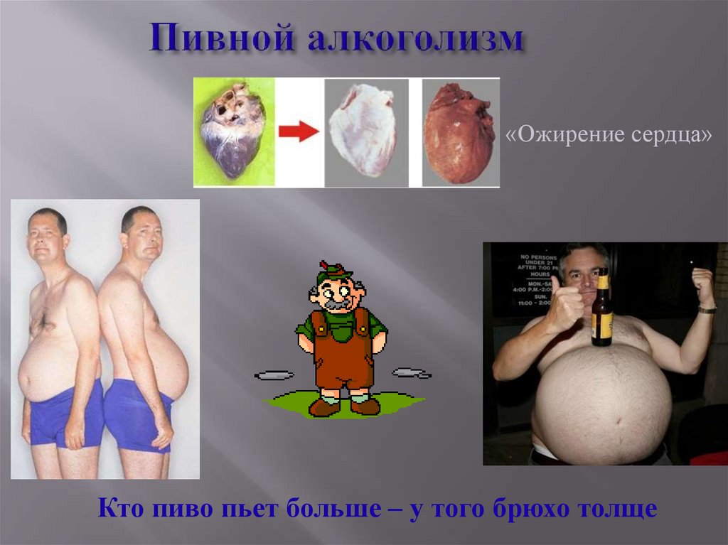 Пивной алкоголизм