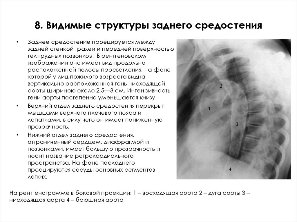 8. Видимые структуры заднего средостения