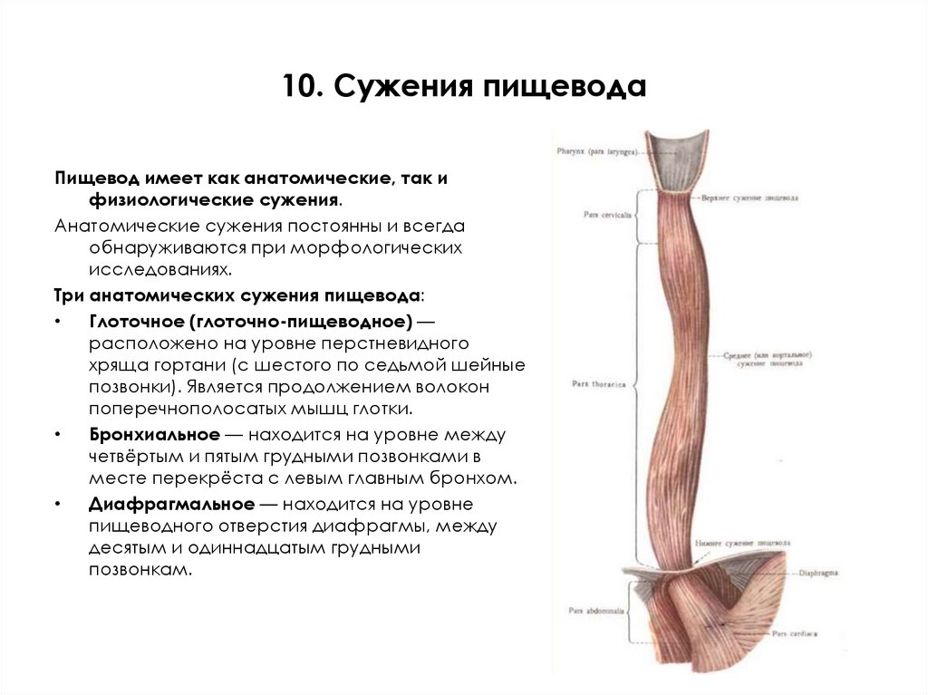 10. Сужения пищевода