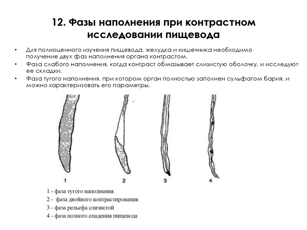 12. Фазы наполнения при контрастном исследовании пищевода
