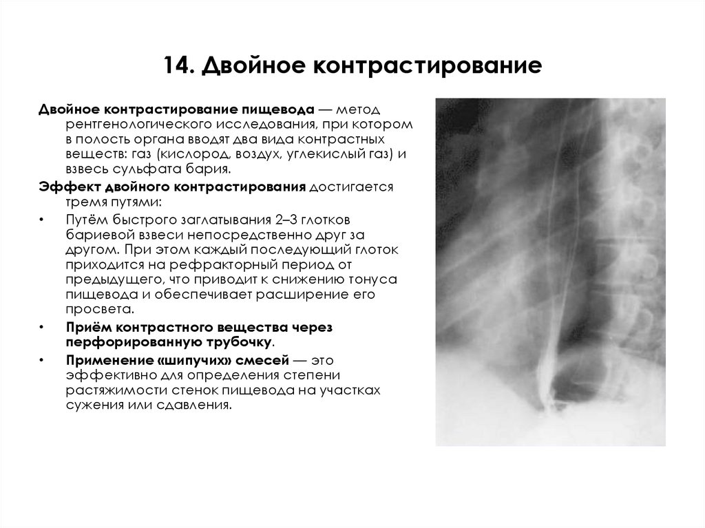 14. Двойное контрастирование