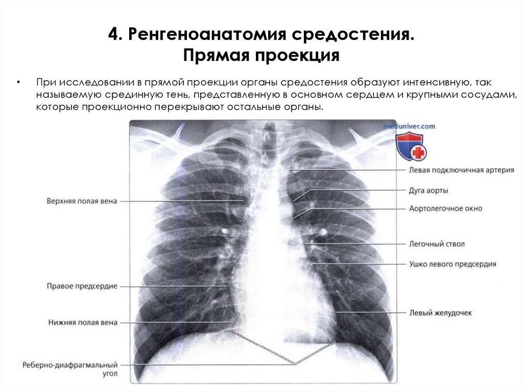 4. Ренгеноанатомия средостения. Прямая проекция