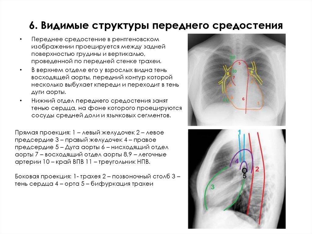 6. Видимые структуры переднего средостения