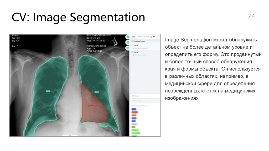 CV: Image Segmentation