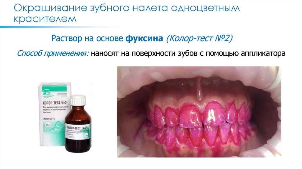 Окрашивание зубного налета одноцветным красителем