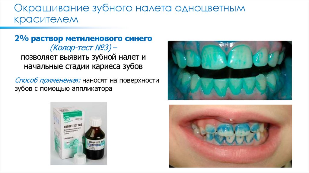 Окрашивание зубного налета одноцветным красителем