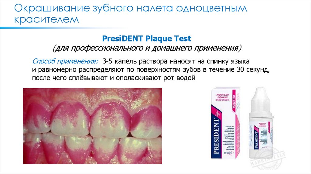 Окрашивание зубного налета одноцветным красителем