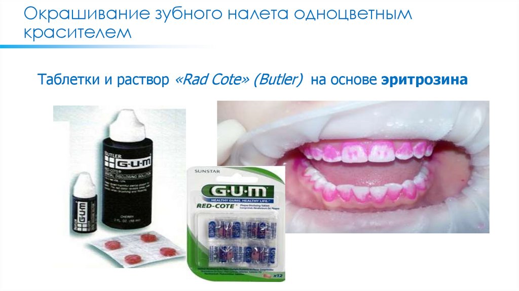 Окрашивание зубного налета одноцветным красителем