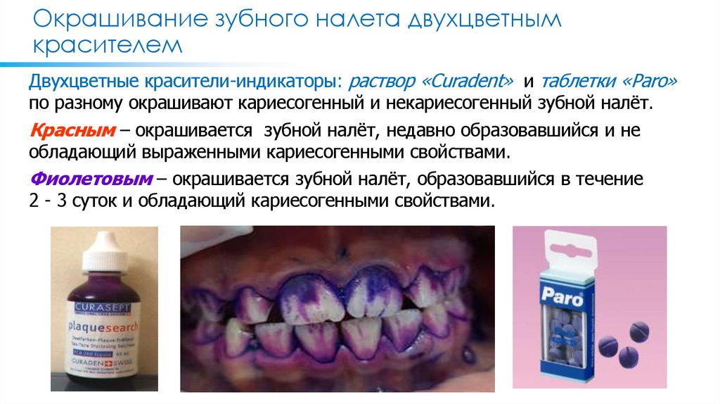 Окрашивание зубного налета двухцветным красителем