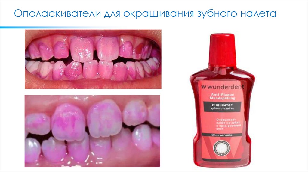 Ополаскиватели для окрашивания зубного налета