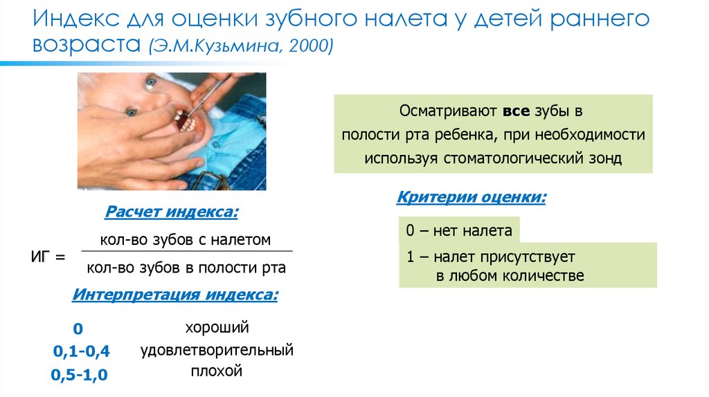 Индекс для оценки зубного налета у детей раннего возраста (Э.М.Кузьмина, 2000)