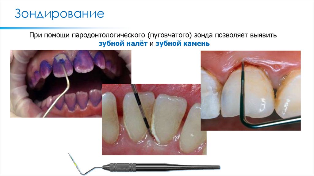 Зондирование