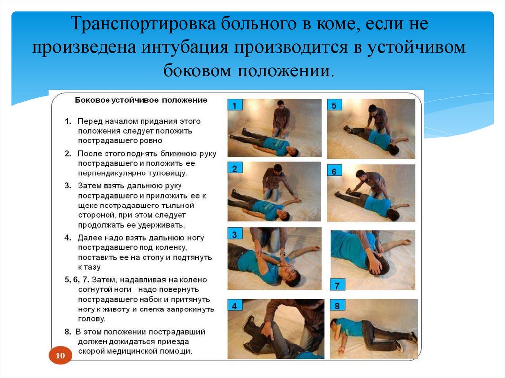 Транспортировка больного в коме, если не произведена интубация производится в устойчивом боковом положении.