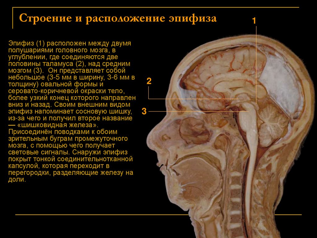 Строение и расположение эпифиза