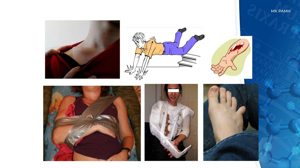 Определение