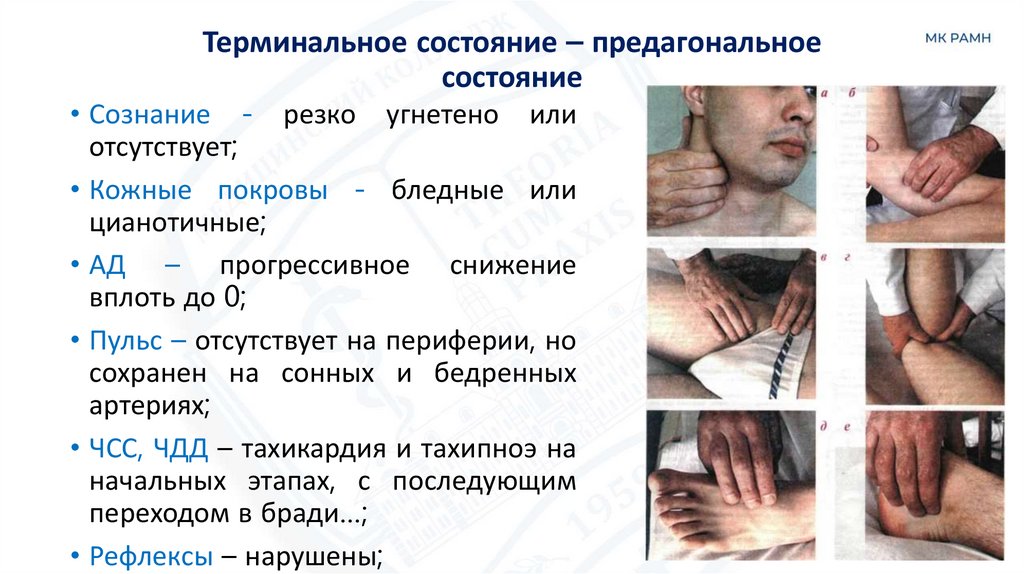 Терминальное состояние – предагональное состояние