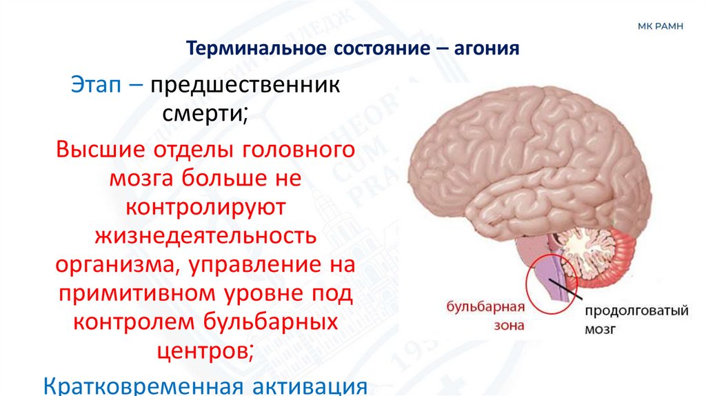 Терминальное состояние – агония