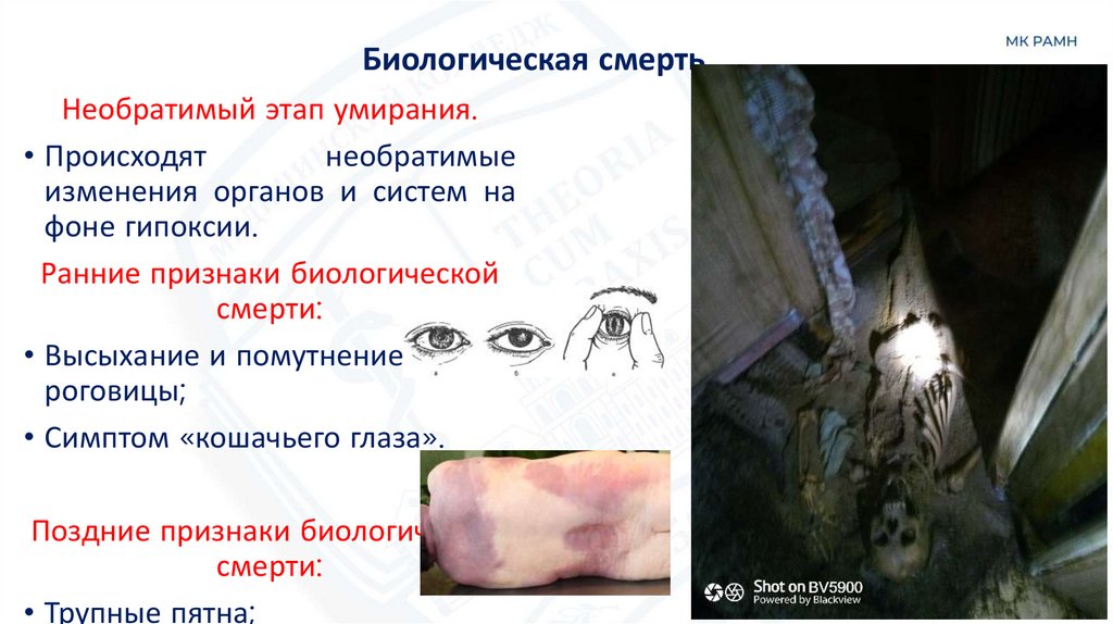 Биологическая смерть