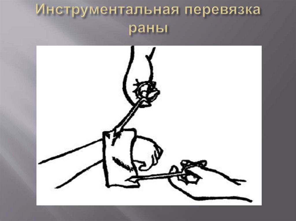 Инструментальная перевязка раны