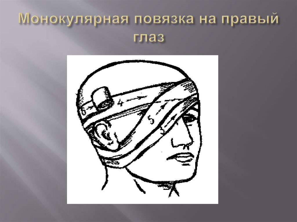 Монокулярная повязка на правый глаз