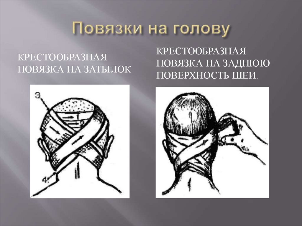 Повязки на голову