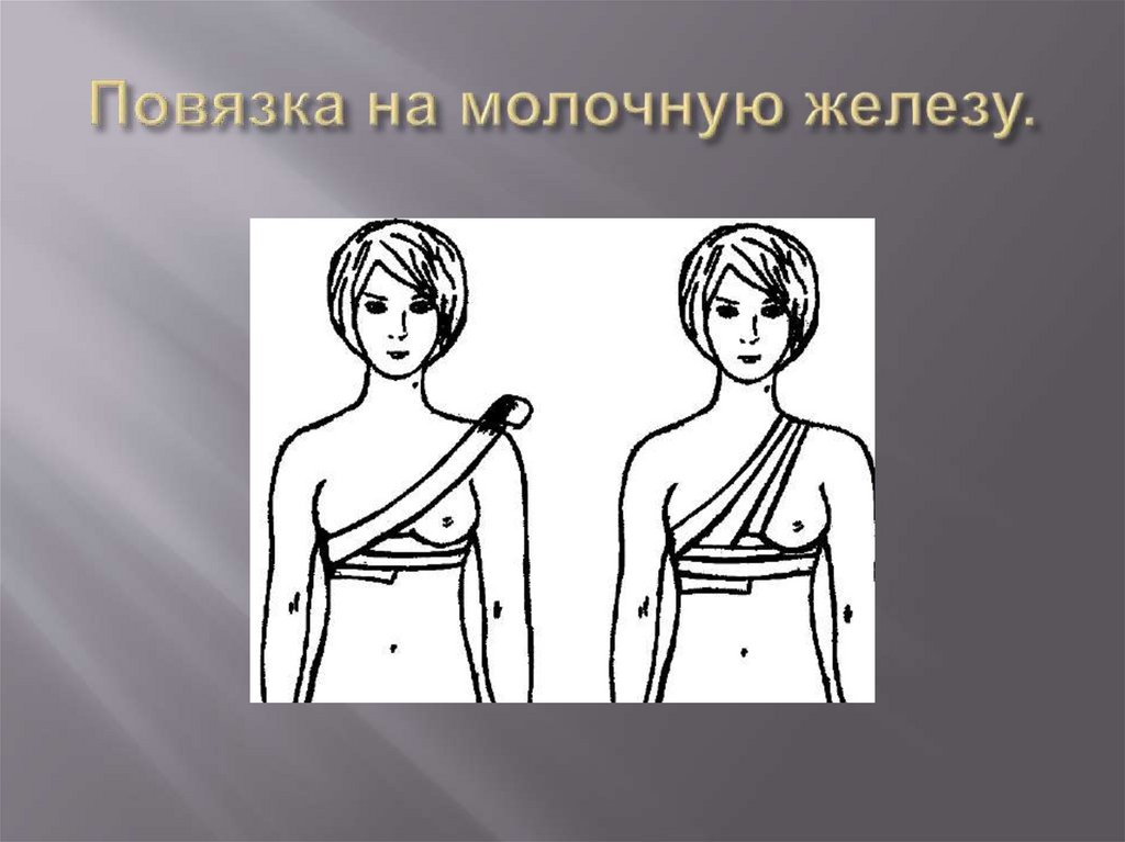 Повязка на молочную железу.