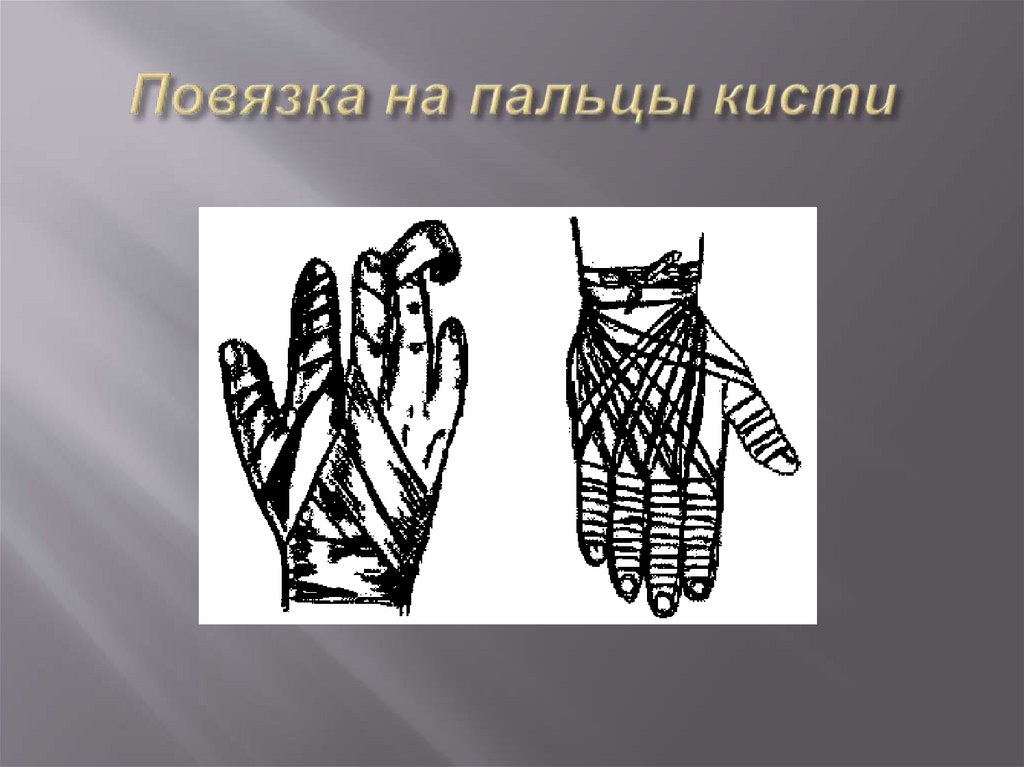 Повязка на пальцы кисти