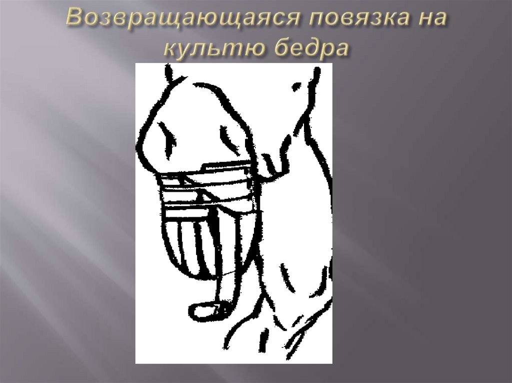 Возвращающаяся повязка на культю бедра