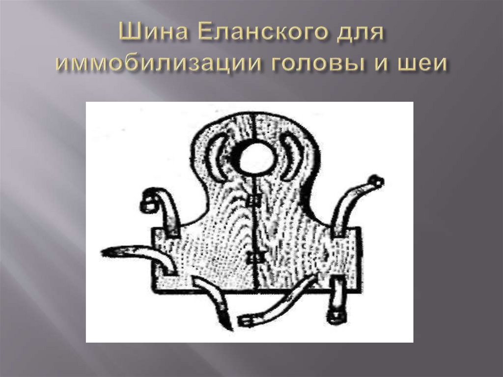 Шина Еланского для иммобилизации головы и шеи