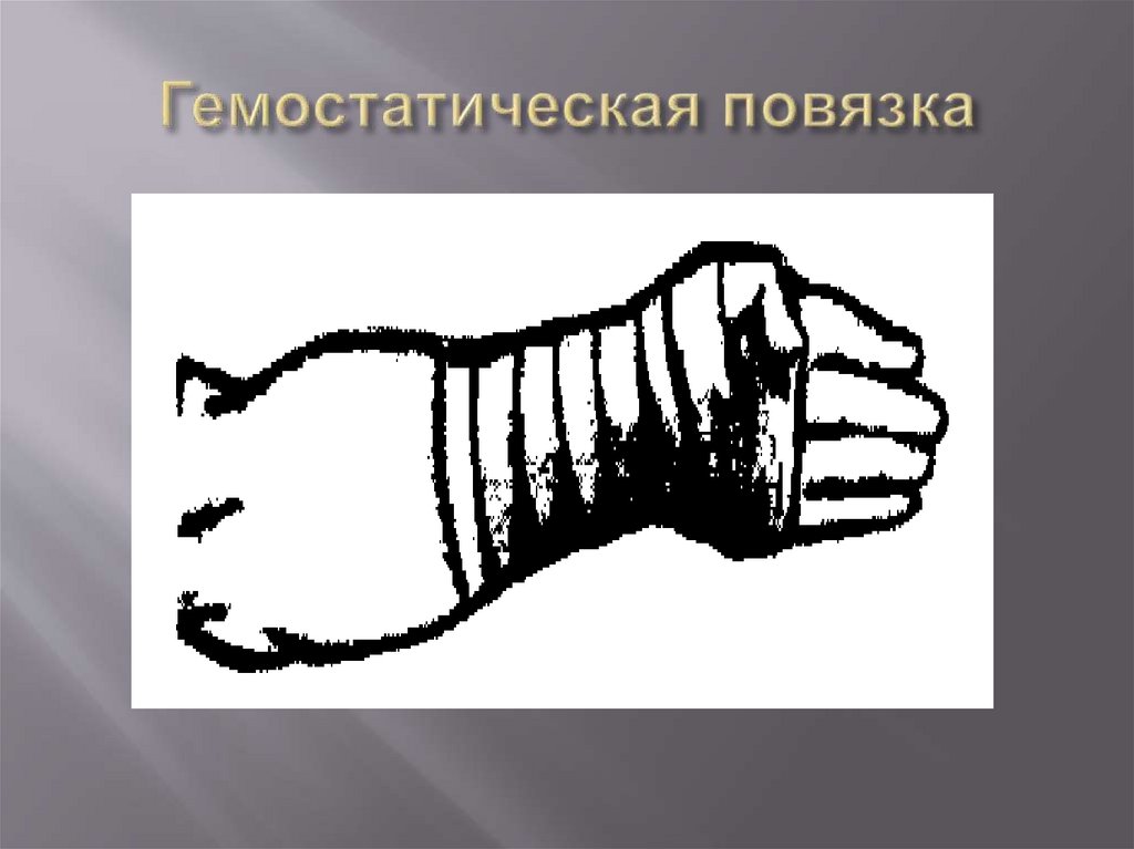 Гемостатическая повязка