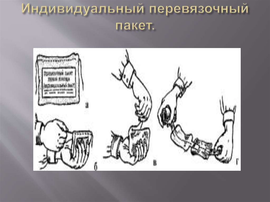 Индивидуальный перевязочный пакет.