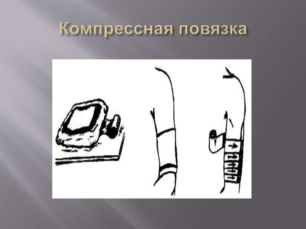 Компрессная повязка
