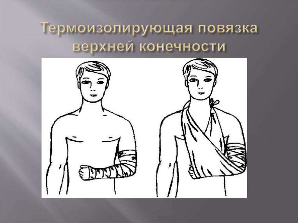 Термоизолирующая повязка верхней конечности