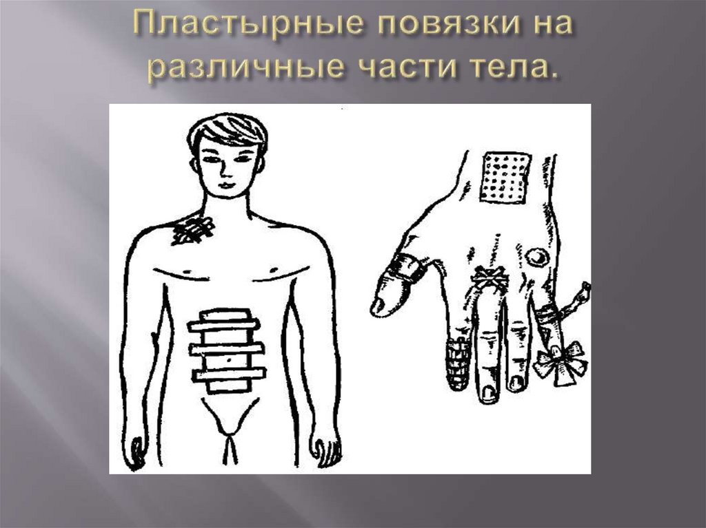 Пластырные повязки на различные части тела.