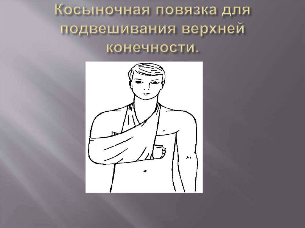 Косыночная повязка для подвешивания верхней конечности.