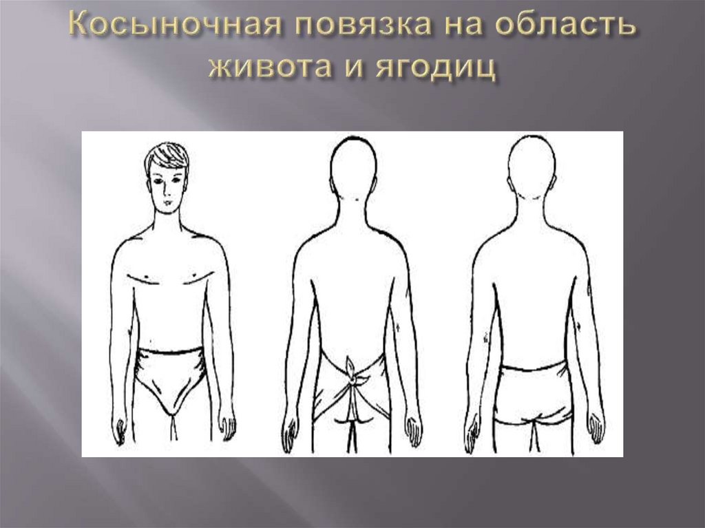 Косыночная повязка на область живота и ягодиц